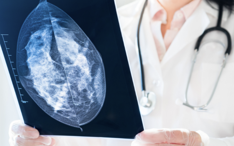 FDA Mandates Breast Density Information with Mammography Results - Healthcare Law Update - April 2023 - Brach Eichler