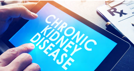Federal Healthcare Law Update – October 2023 - Brach Eichler - Chronic Kidney Disease Improvement In Research and Treatment Act Reintroduced in Congress