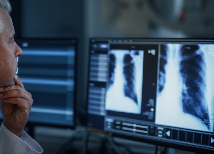 Breach of Unsecured Server Results in Monetary Penalty and Corrective Action Plan - Healthcare Law Update - June 2025 - Brach Eichler Breach of Unsecured Server Results in Monetary Penalty and Corrective Action Plan - Healthcare Law Update - June 2025 - Brach Eichler